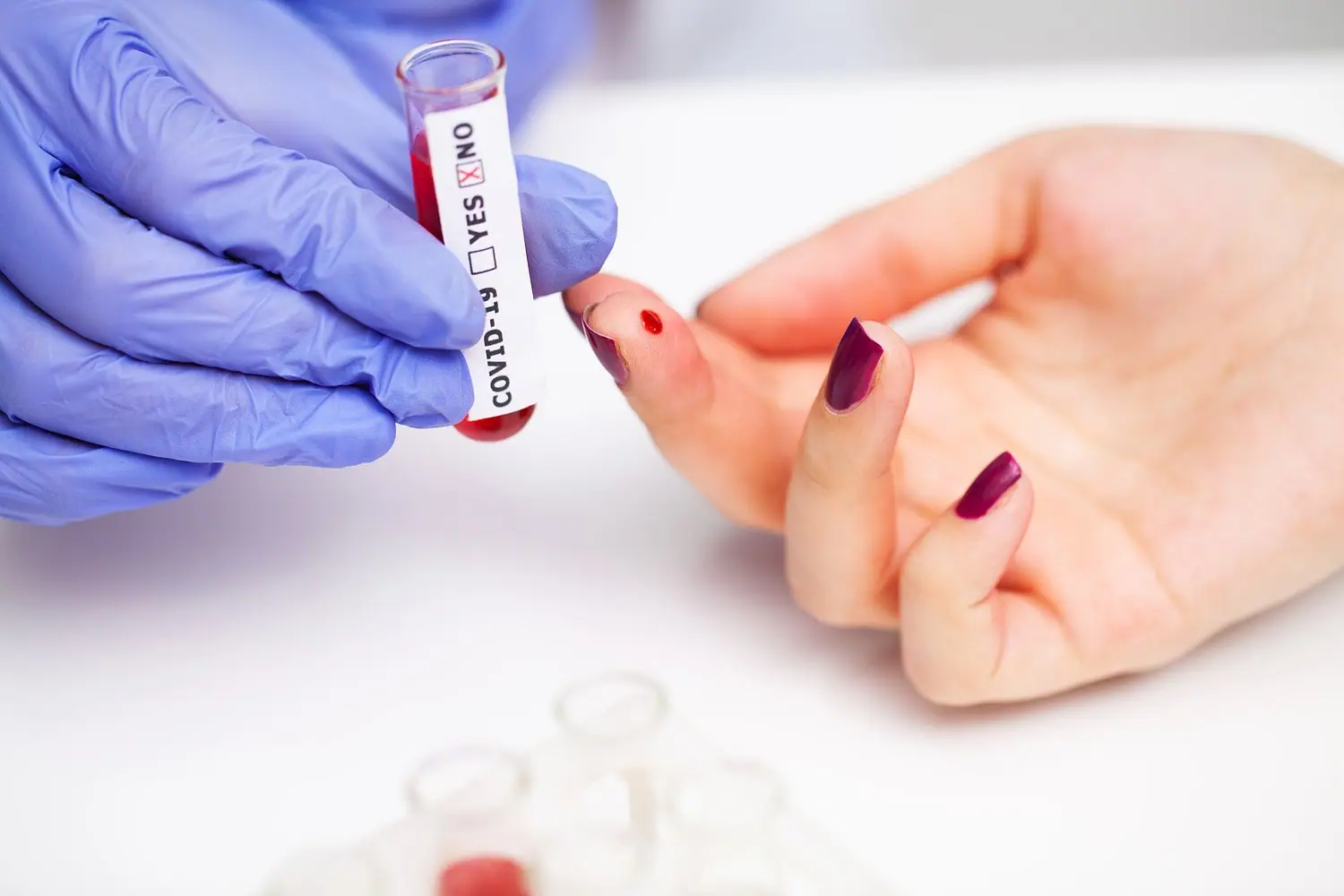 Jak przygotować się do badań laboratoryjnych? Zasady przed pobraniem krwi